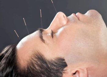 9 مزیت شگفت انگیز طب سوزنی