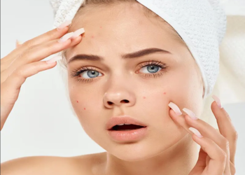 10درمان خانگی موثر و ایمن برای آکنه